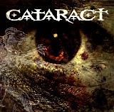 Cataract - Cataract