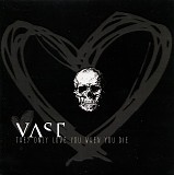 VAST - They Only Love You When You Die